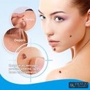 Cvreoz® | Spray Criogênico para Verrugas e Condiloma