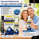 Cvreoz® | Spray Criogênico para Verrugas e Condiloma