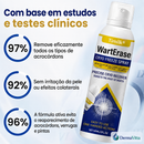 Spray Criogênico para Verrugas