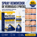 Spray Criogênico para Verrugas