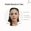 PROTOUCH Glow Pro | Lifting Facial por Microcorrente em Casa