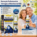 Spray Criogênico para Verrugas