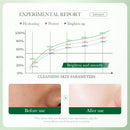BIOAQUA Centella Asiatica Limpador Facial Controle de Óleo Hidratante Limpeza Facial Lavagem Facial Espuma Limpador Facial Cuidados com a Pele