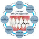 Gel Dental Clareador FreshSmile