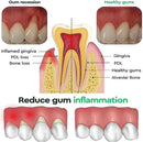 Gel Dental Clareador FreshSmile